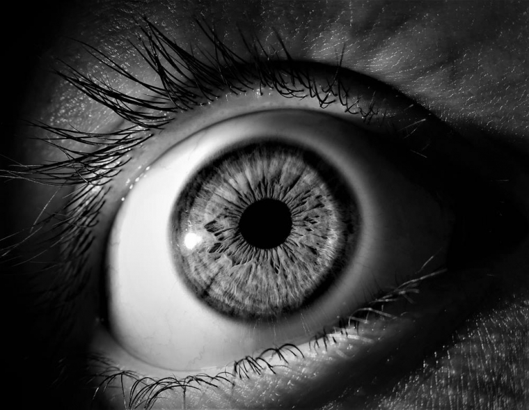 Une opération de chirurgie des yeux au laser à Villeurbanne est-elle douloureuse ?, Lyon, Docteur Ygal Boujnah
