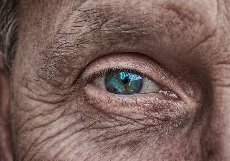 Peut-on lutter contre le vieillissement des yeux ?, Lyon, Docteur Ygal Boujnah