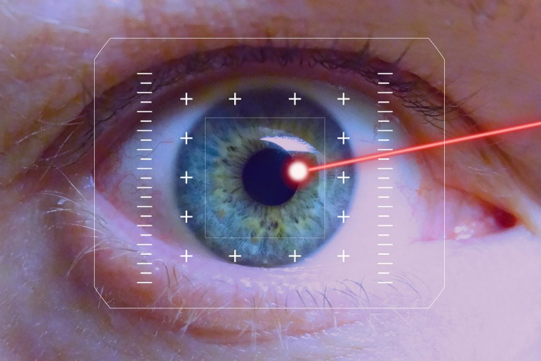 Pourquoi les opérations laser des yeux pour la myopie à Lyon sont chères ?, Lyon, Docteur Ygal Boujnah