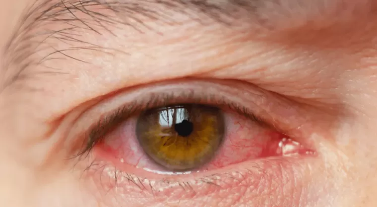 Quelles sont les principaux effets secondaires d’une chirurgie laser ?, Lyon, Docteur Ygal Boujnah